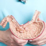 دکتر معده در تهران