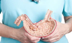 دکتر معده در تهران