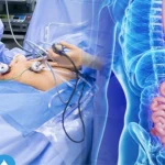 دکتر معده در کرمان